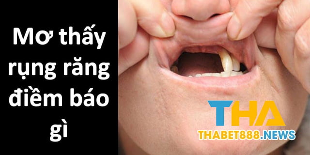 Gãy răng và không chảy máu